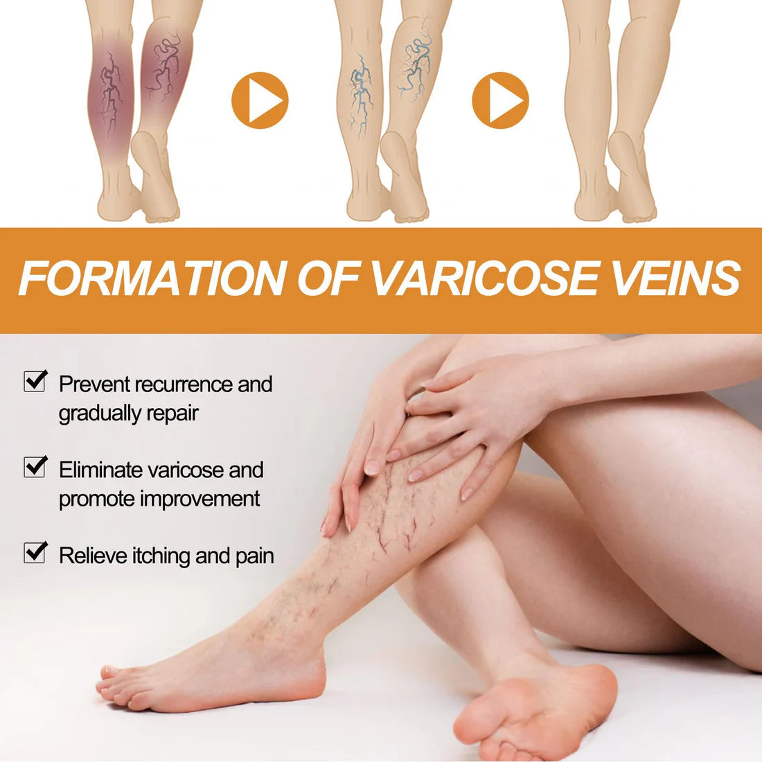 [Original] Vericose Vein Relief Spary (Pack Of 2)