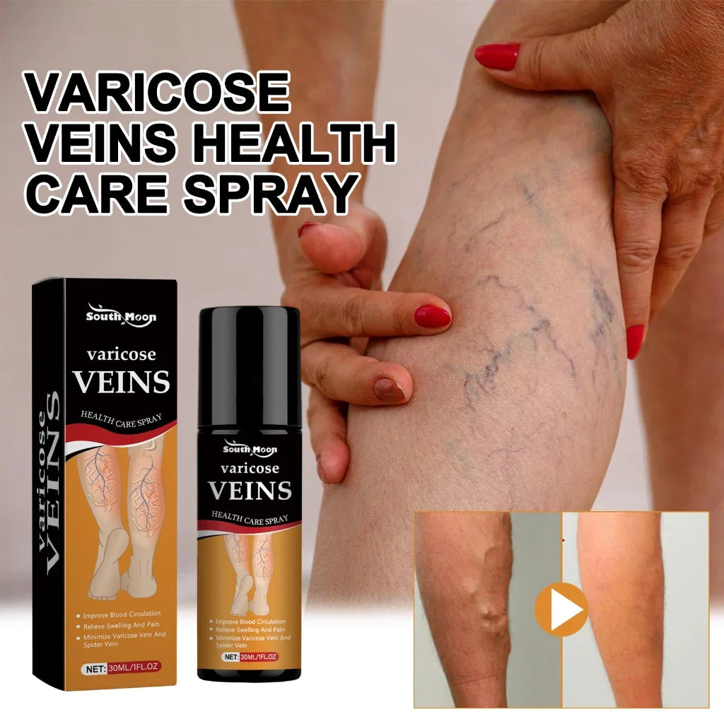 [Original] Vericose Vein Relief Spary (Pack Of 2)